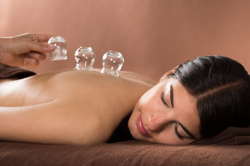 Where does cupping come from, and what are the benefits?