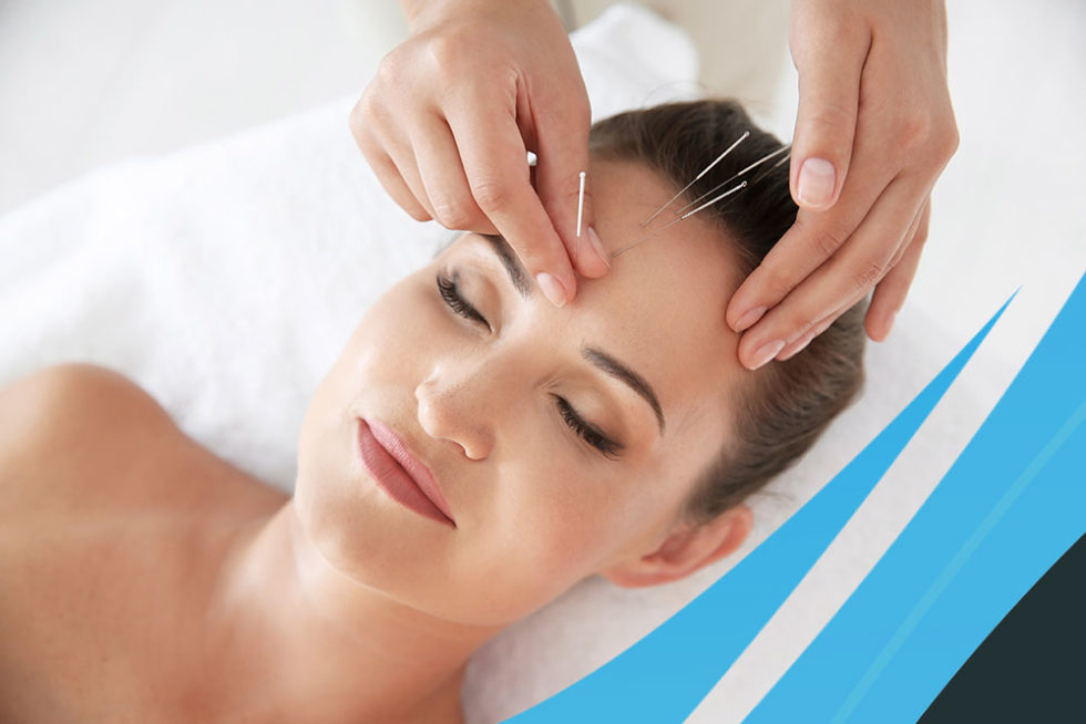 Acupuncture in Montreal, WestIsland and IlePerrot Cappino